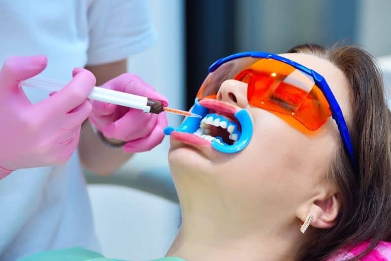 Get a brighter smile in minutes with instant results whitening Hastings