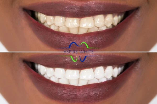 Side-by-side comparison showing before and after results of a cosmetic treatment Hastings